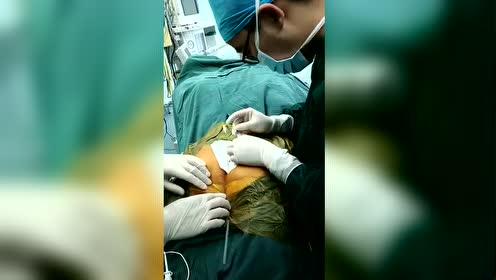 变性手术全过程-腾讯视频