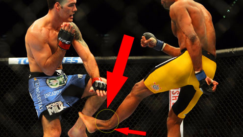 ufc蜘蛛人安德森·席尔瓦断腿之后模仿李小龙0:00:21简 介:魏德曼断腿