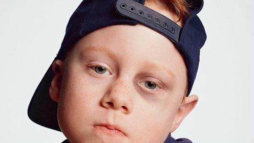 熬夜看世界杯的你会有黑眼圈吗?教你一招,快速去除黑眼圈