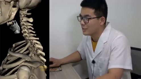 治疗颈椎压迫神经 腾讯视频