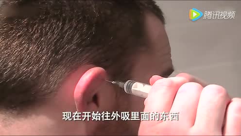 饺子耳 腾讯视频