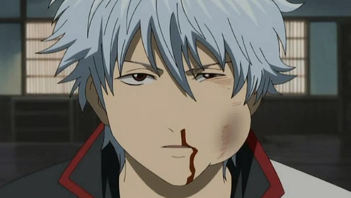 银魂:银桑的认错态度很好,可惜还是被阿妙暴揍得鼻青脸肿