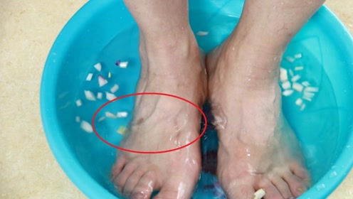 脚气治疗 腾讯视频