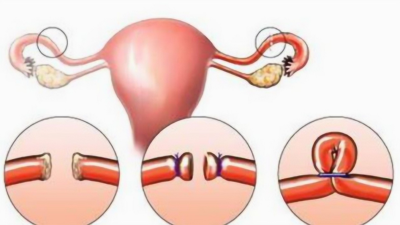 没有"子宫"的女性,"结扎"后的男性,和平常人有啥不同?看完背后一凉!