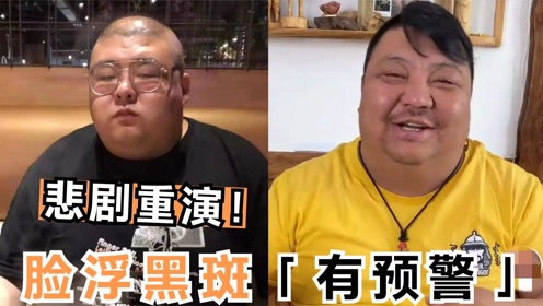 泡泡龙悲剧重演!300斤网红脸长黑斑口齿不清,直播昏睡早有预警
