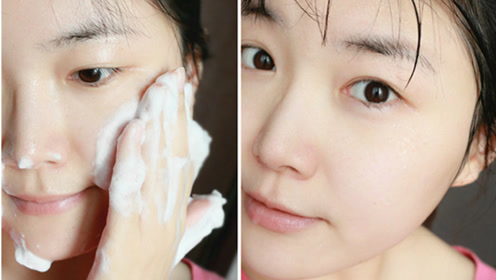 专业的挑粉刺!你学会了么?