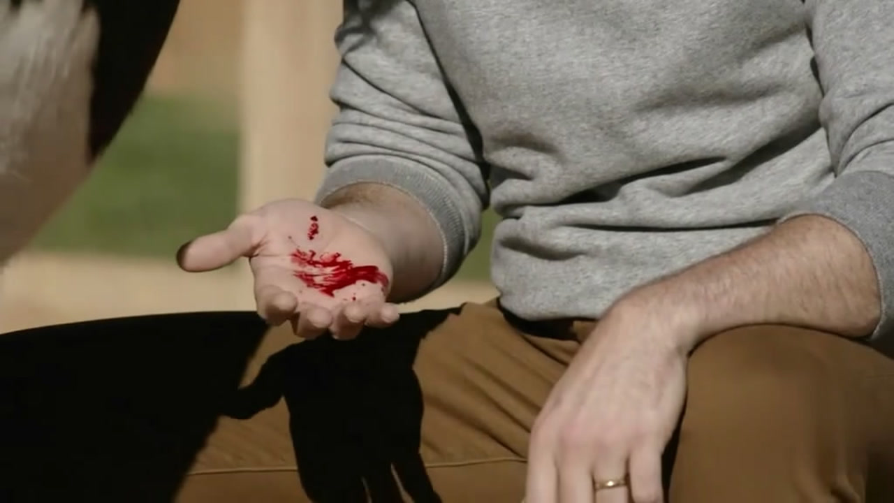 男子突然咳出血,众人认为他感染了病毒,吓得不敢靠近