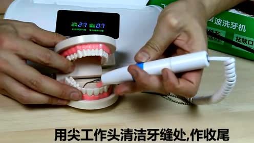 家用超声波洗牙机 腾讯视频