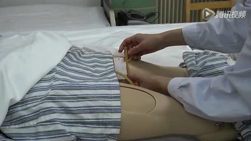 尿管i型法固定.mp4
