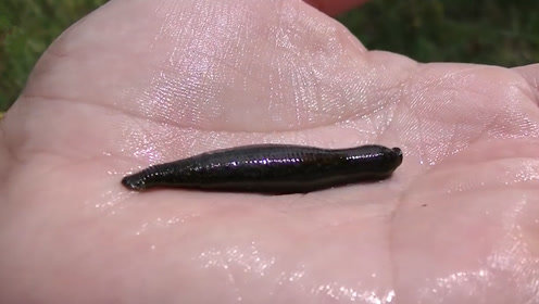 水蛭又名吸血虫,老外在实验它们的威力,果然名符其实