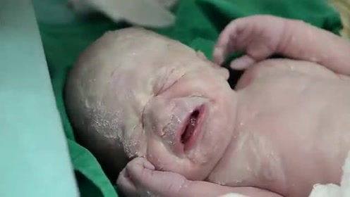 漂亮孕妈妈剖腹产生子全过程,宝宝出生时妈妈的哽咽令人心疼!