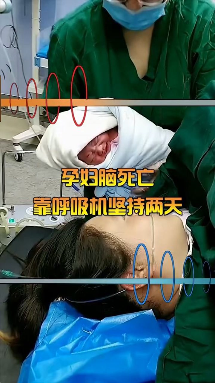 孕妇脑死亡,靠呼吸机生下孩子,让人感叹母爱的力量