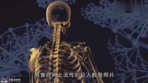 巨人骸骨 腾讯视频