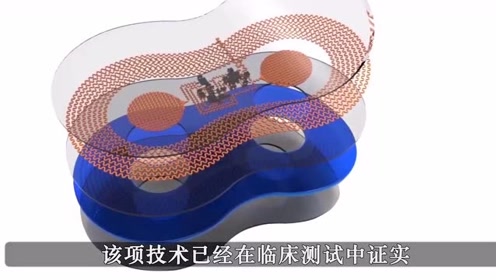 腾讯视频