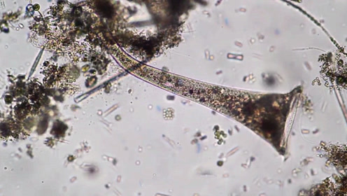 看看显微镜下的一滴水,你还敢喝吗?