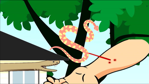 毒蛇咬人科普英语学习