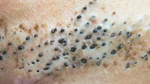 美容院小妹,背着老板告诉我去黑头秘方,永不反弹