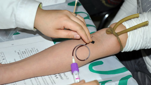 为什么去医院化验的时候,要抽那么多血?答案不是你想的那样