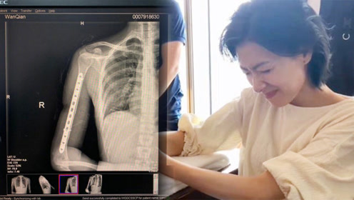 腾讯视频
