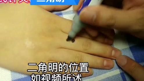 眉棱骨痛 腾讯视频