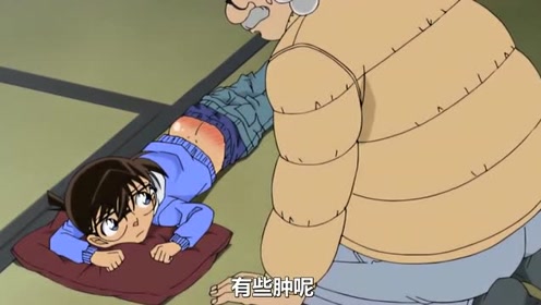 名侦探柯南,小哀偷偷往柯南裤子里放辣椒,结果柯南的屁股肿了