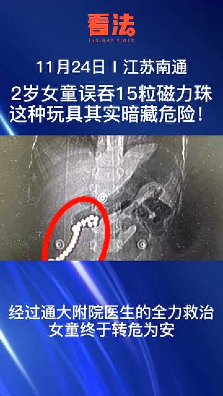 女童误食15粒磁力珠,这种小玩具也可能致命!