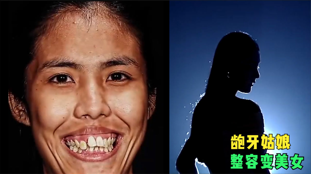 龅牙姑娘整容后变美女,灯光亮起的瞬间,在场观众掌声不断