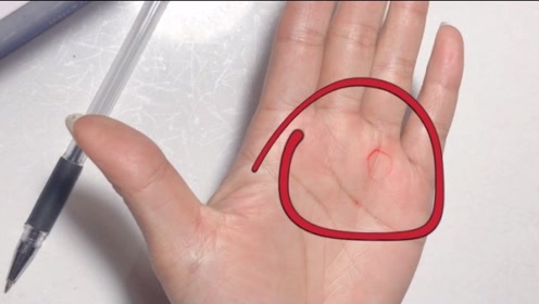 太阳丘突出饱满的人特有福气,男性财气旺,女性易嫁有钱人