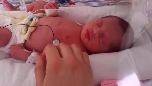 33周早产儿 腾讯视频