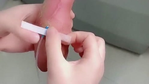 找血管 腾讯视频