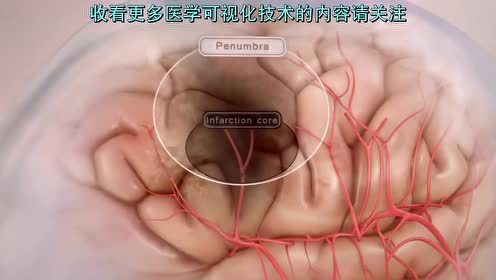 腾讯视频