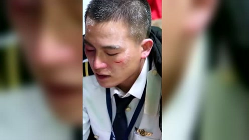 中国机长:欧豪的特效妆,参考了原型副机长徐瑞辰的受伤图片,好惨一男
