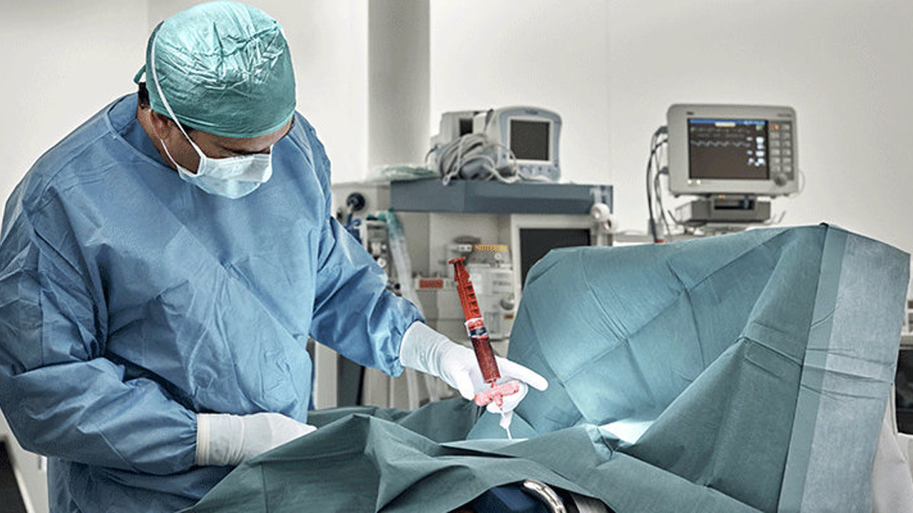 骨髓移植是如何采集骨髓的?一次可以采多少?