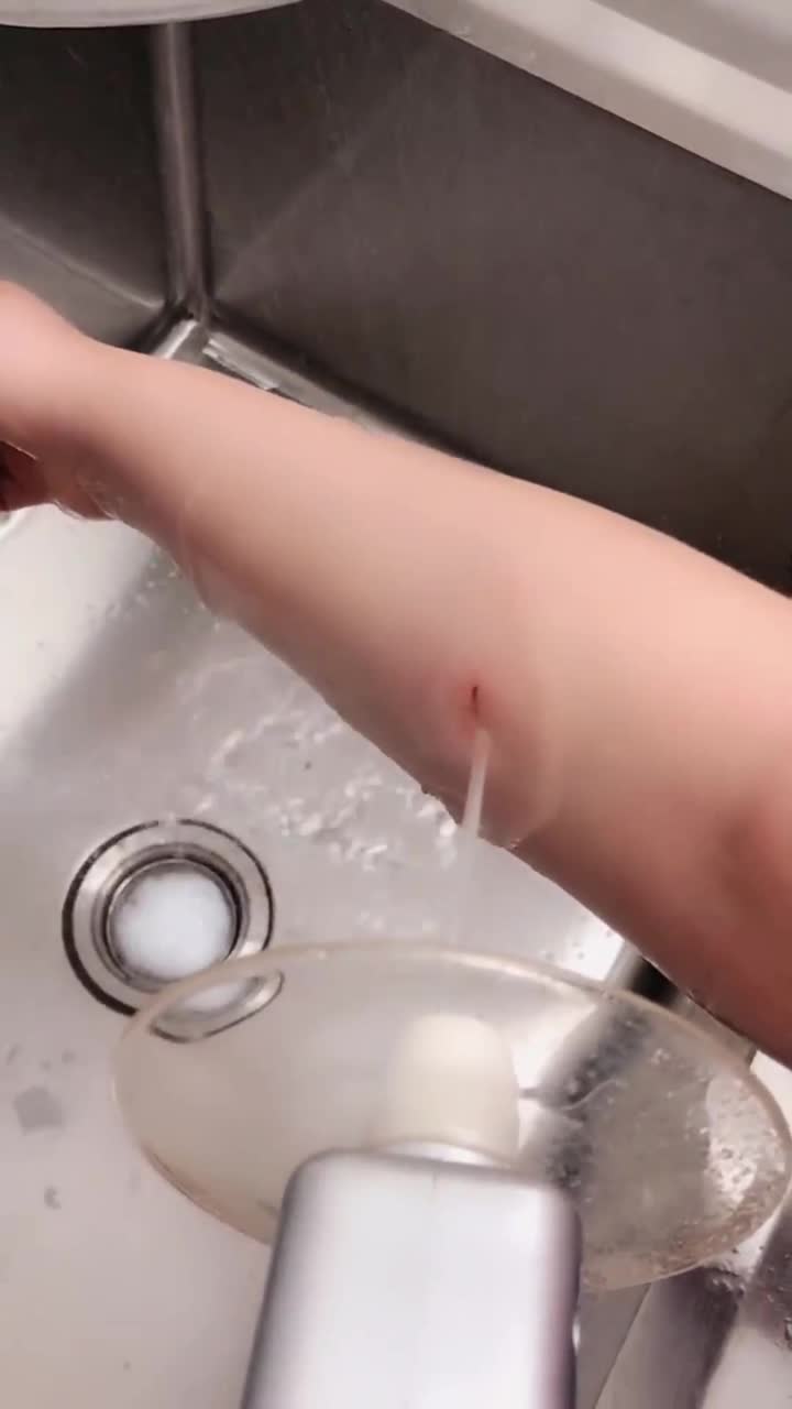 妹子胳膊上有个小口子,网友:这是怎么了还要打针