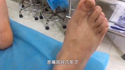 脚踝痛 腾讯视频