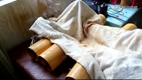 易筋熏灸筒灸治中风后遗症