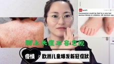 欧洲儿童爆发新冠病毒,出现了这些症状,请父母仔细关注孩子