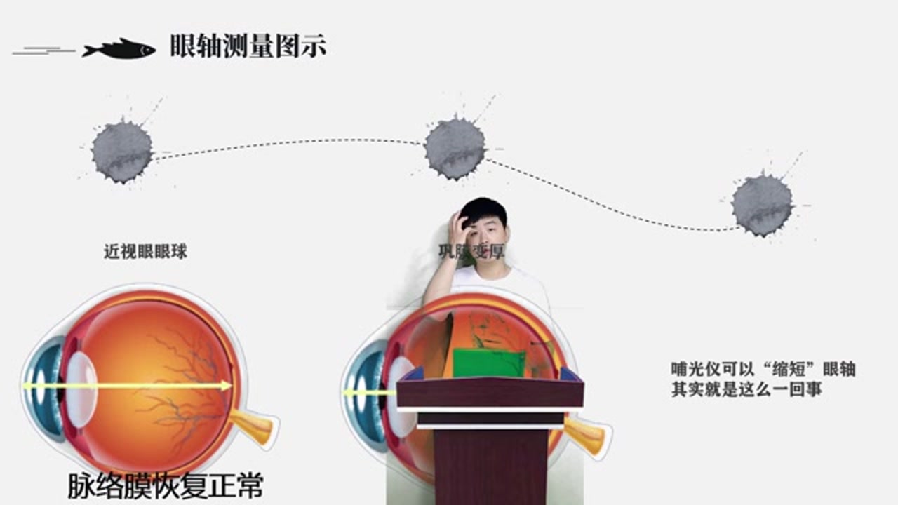哺光仪原理及作用你不知道的事-莲子视光zjing