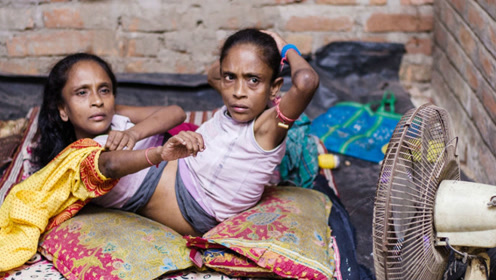 印度连体姐妹,共用下半身,嫁给同一个男子!