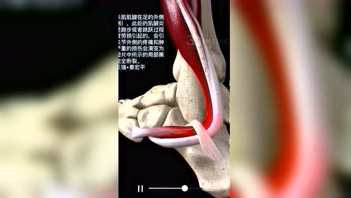腓骨肌腱 腾讯视频