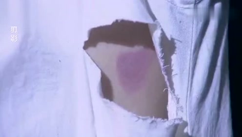 医生剪开美女内衣_美女被医生剪开衣服(3)