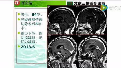 腾讯视频