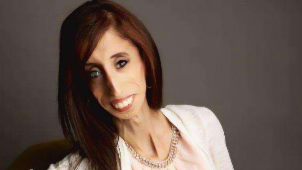 世界上最丑的女人,丑如魔鬼,心如天使,"零脂肪女孩"震撼人心!