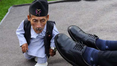 世界上最小的老人,酷似小孩的他已经72岁高龄,背后故事让人心疼