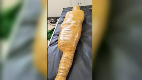 菲律宾一医院将车祸死者用胶带捆成木乃伊 事后辩称"怕传染新冠"