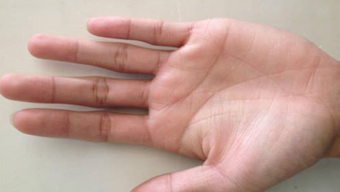 手诊:手掌纹出现这条线,注意糖尿病