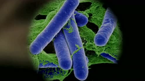 又有了新的线索,夏洛克在显微镜里看到这是肉毒杆菌