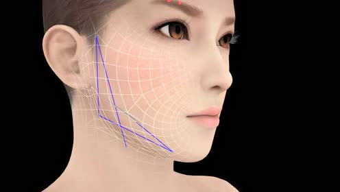 线雕 下颌缘提升紧致