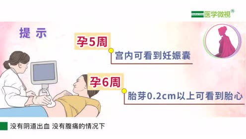 怀孕初期的妊娠 腾讯视频