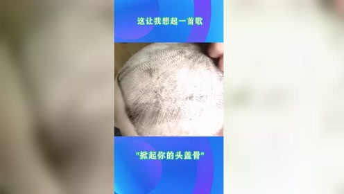 掀起你的头盖骨 腾讯视频